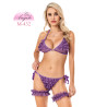 Стилен Babydoll Комплект от Дантелен Сутиен и Бразилиани с Жартиери